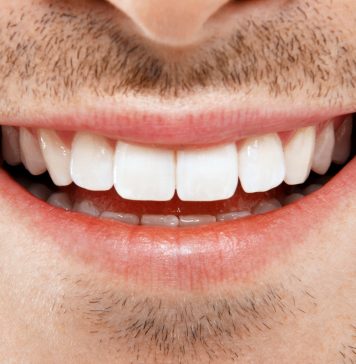 Преимущества имплантации зубов