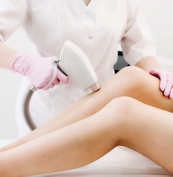 Что нужно знать о лазерной эпиляции