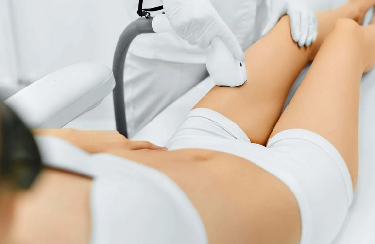 Что нужно знать о лазерной эпиляции