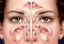 Гайморит: причины, симптомы и лечение