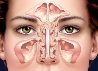 Гайморит: причины, симптомы и лечение