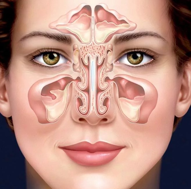 Гайморит: причины, симптомы и лечение