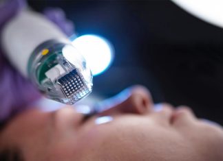 Игольчатый RF-лифтинг: что это такое и особенности процедуры