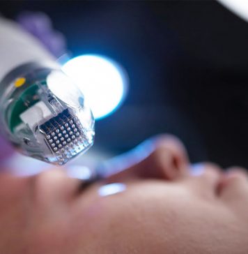 Игольчатый RF-лифтинг: что это такое и особенности процедуры