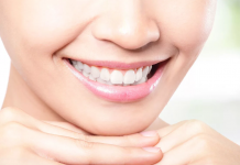 Преимущества установки зубных протезов