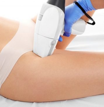 Почему лазерная эпиляция так популярна