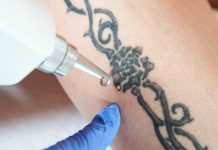 Сведение тату