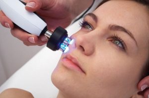 Термолифтинг: Секрет молодости и красоты