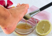 Виды мозолей: как подолог определяет тип перед удалением