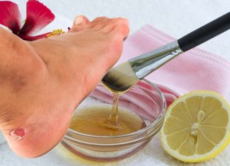 Виды мозолей: как подолог определяет тип перед удалением