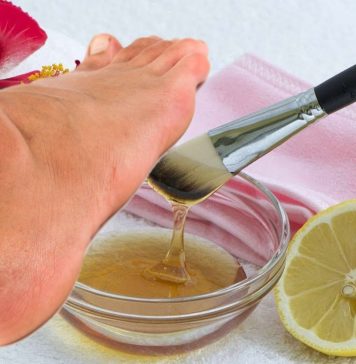 Виды мозолей: как подолог определяет тип перед удалением