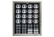 Негатоскоп: устройство, принцип работы и применение