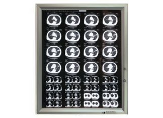 Негатоскоп: устройство, принцип работы и применение