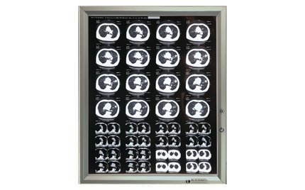 Негатоскоп: устройство, принцип работы и применение