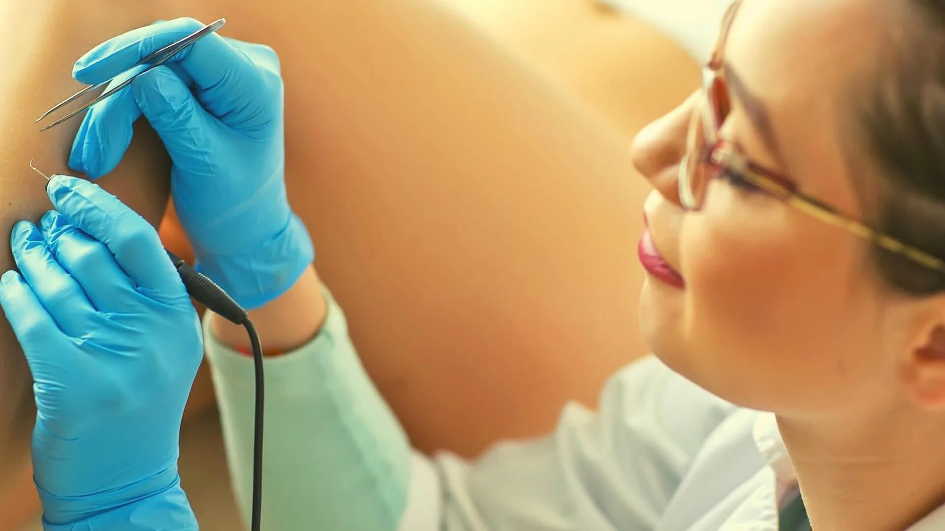 Уход за кожей после электроэпиляции