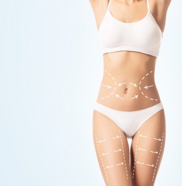 Бинарная липосакция ― что это