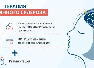 Рассеянный склероз: признаки и симптомы
