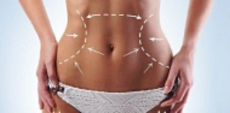 Безоперационная подтяжка тела Ulthera System