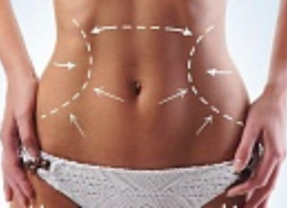 Безоперационная подтяжка тела Ulthera System