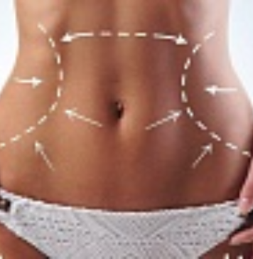 Безоперационная подтяжка тела Ulthera System