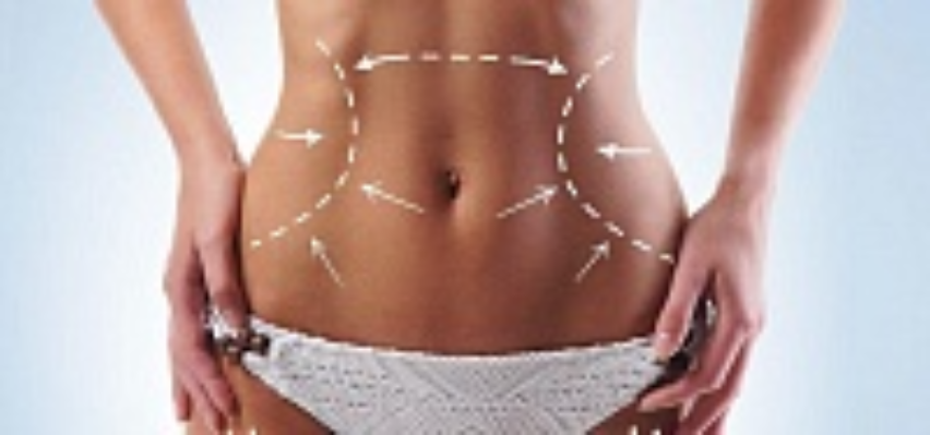 Безоперационная подтяжка тела Ulthera System