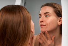 Причины акне: гормоны, бактерии и питание