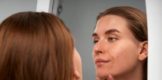 Причины акне: гормоны, бактерии и питание