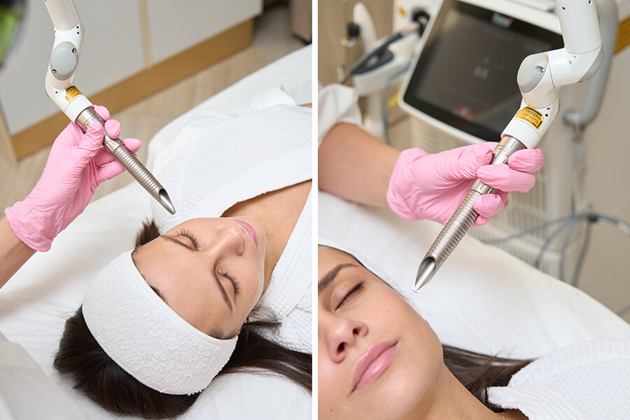 Fotona 4D: инновационная методика для омоложения и здоровья кожи