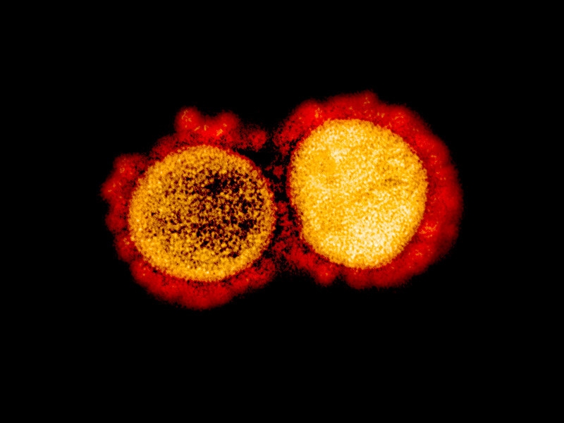 Американские ученые перевели колебания белков SARS-CoV-2 в звук - получилась успокаивающая мелодия коронавируса