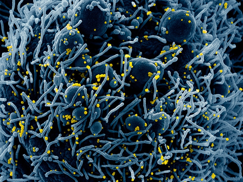 Границы стран Шенгенской зоны могут остаться на замке до сентября