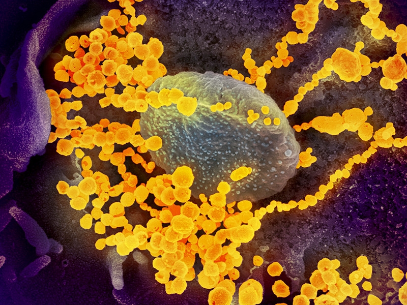 Назван средний инкубационный период коронавируса и найден его новый необычный симптом - аносмия или гипосмия