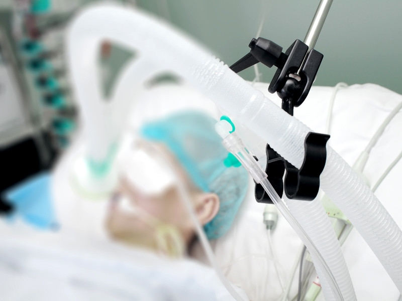 Сразу несколько международных исследований поставили под сомнение преимущества ИВЛ в борьбе с COVID-19