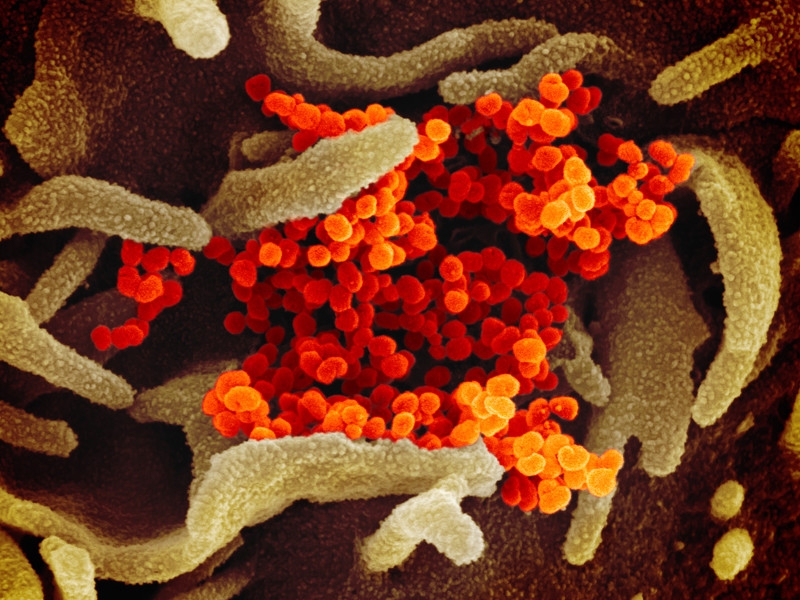 В развитых странах официально регистрируется не больше 15% случаев заражения коронавирусом