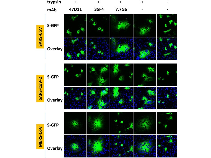 Вакцины, целебные отвары, антитела: как пытаются лечить новый корановирус COVID-19